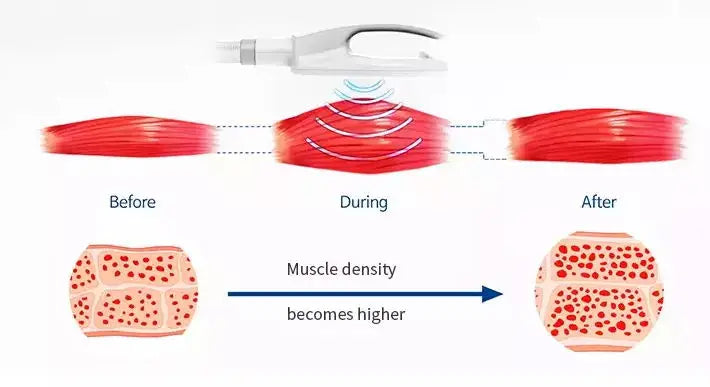 DLS-EMSlim HI-EMT Fat Burning Beauty Machine