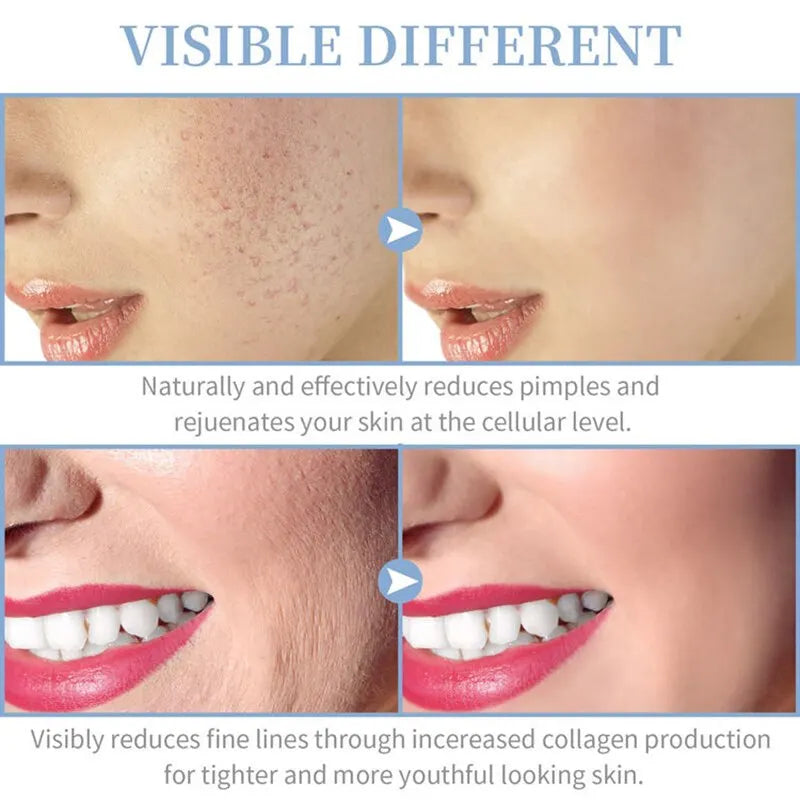 High Frequency Skin Therapy Wand Machine