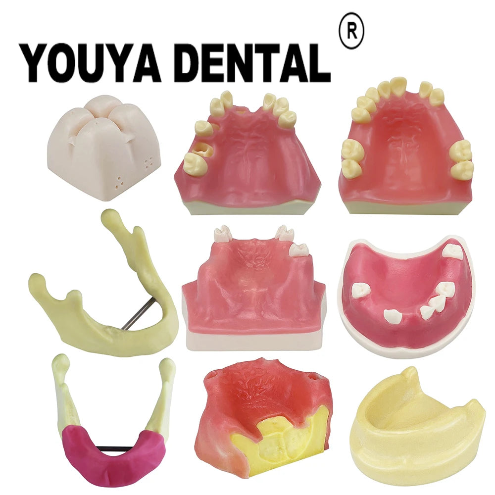 Dental Maxillary Implant Practice Model