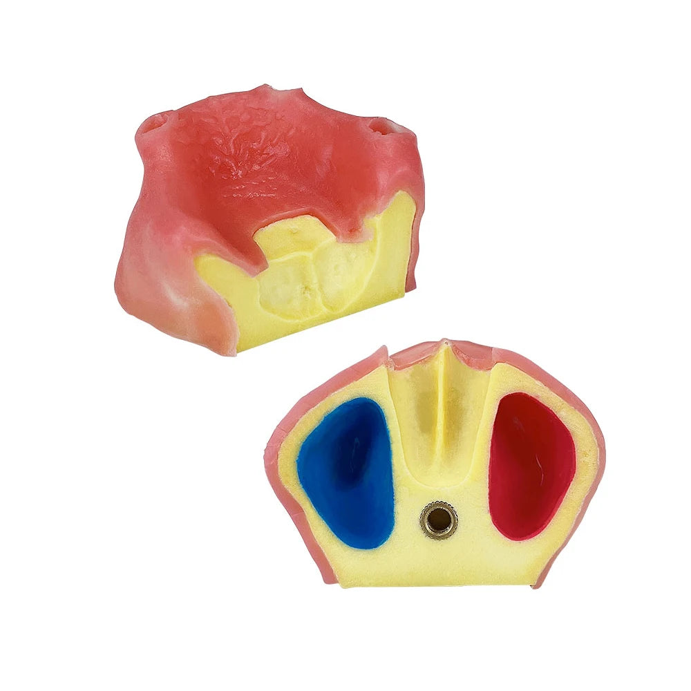 Dental Maxillary Implant Practice Model