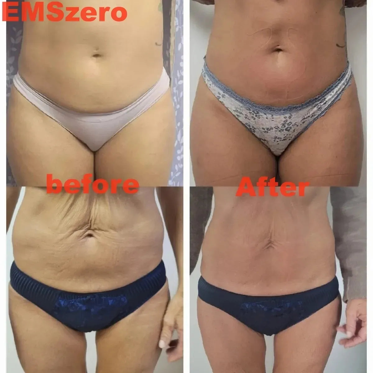 Body Sculpting Slimming Machine