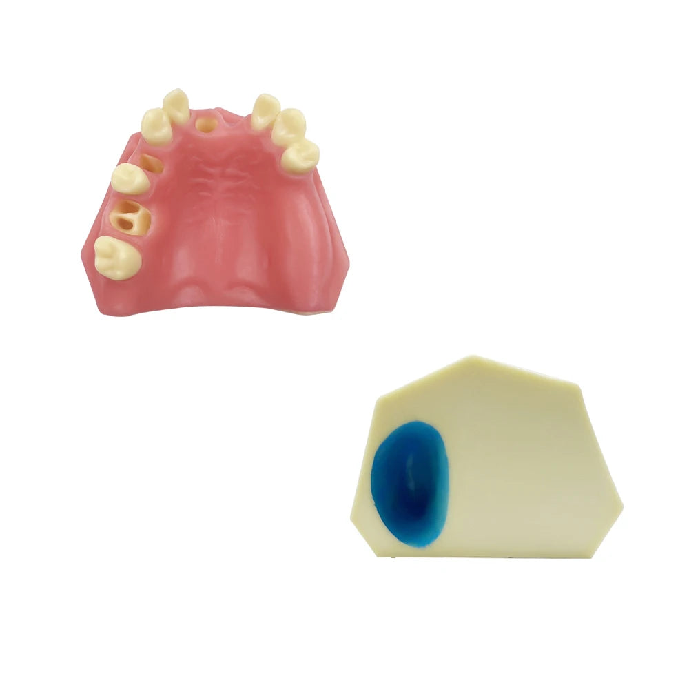 Dental Maxillary Implant Practice Model