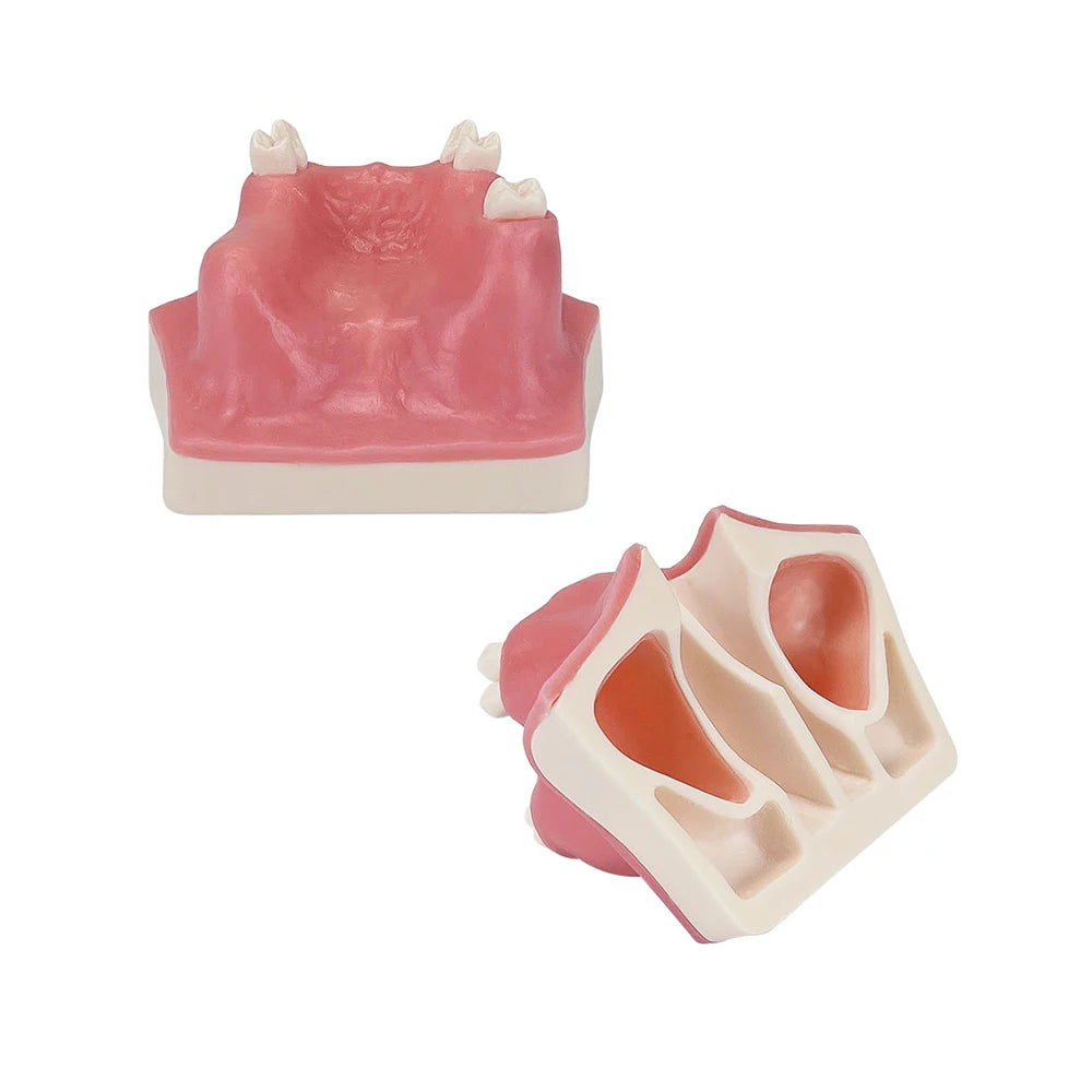 Dental Maxillary Implant Practice Model